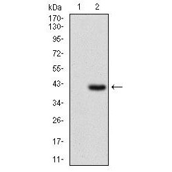 Interleukin 2 Receptor Alpha (IL2RA) Antibody