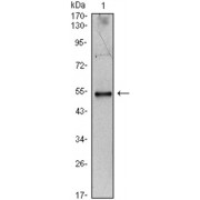 Western blot analysis using IL34 antibody against IL34-hIgGFc transfected HEK293 cell lysate.