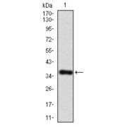Western blot analysis using IL3RA antibody against human IL3RA recombinant protein. (Expected MW is 38.3 kDa).