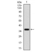 Western blot analysis using IL3RA antibody against human IL3RA recombinant protein. (Expected MW is 38.3 kDa).