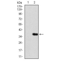 Interleukin 3 Receptor alpha (IL3RA) Antibody