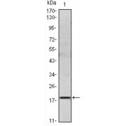 Western blot analysis using IL6 antibody against IL6 recombinant protein.