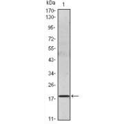 Western blot analysis using IL6 antibody against IL6 recombinant protein.