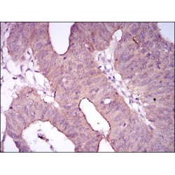 Integrin Alpha IIb / CD41 (ITGA2B) Antibody