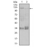 Western blot analysis using ITGB1 antibody against human ITGB1 (AA: 50-270) recombinant protein. (Expected MW is 50.6 kDa).