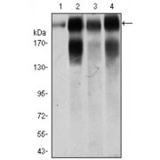 Western blot analysis using ITGB4 antibody against human ITGB4 recombinant protein. (Expected MW is 24 kDa).