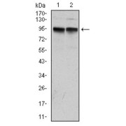 Western blot analysis using KCNQ1 antibody against human KCNQ1 (AA: 229-347) recombinant protein. (Expected MW is 74.7 kDa).