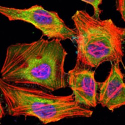 Lysine-Specific Demethylase 3A (KDM3A) Antibody