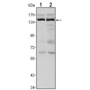 Western blot analysis using KDM3A antibody against Hela (1) and HepG2 (2) cell lysate.