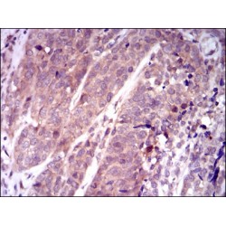 Kelch Like ECH Associated Protein 1 (KEAP1) Antibody