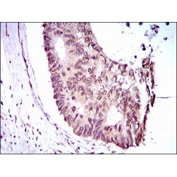 Krueppel-Like Factor 1 (KLF1) Antibody