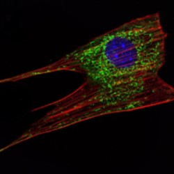 Kelch-Like Protein 11 (KLHL11) Antibody