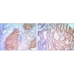 Kelch-Like Protein 11 (KLHL11) Antibody