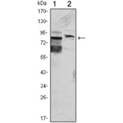 Western blot analysis using KLHL11 antibody against Hela (1) and MCF-7 (2) cell lysate.