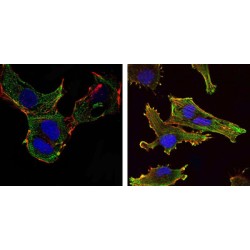 Kelch-Like Protein 13 (KLHL13) Antibody