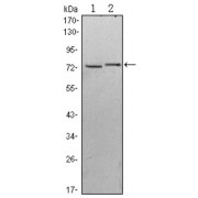 Western blot analysis using KLHL13 antibody against Hela (1) and MCF-7 (2) cell lysate.