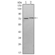 Western blot analysis using KLHL13 antibody against Hela (1) and MCF-7 (2) cell lysate.