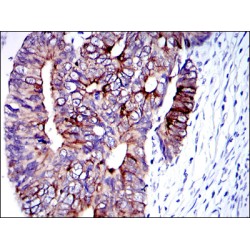 Keratin 19 (KRT19) Antibody