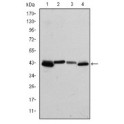 Western blot analysis using KRT19 antibody against human KRT19 (AA: 115-269) recombinant protein. (Expected MW is 43.1 kDa).