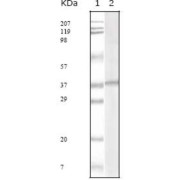 Western blot analysis using KSHV ORF62 antibody against KSHV ORF62 recombinant protein.