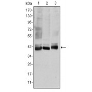 Western blot analysis using MAP2K4 antibody against HepG2 (1), K562 (2), and HEK293 (3) cell lysate.