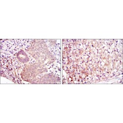 Dual Specificity Mitogen-Activated Protein Kinase Kinase 6 (MAP2K6) Antibody