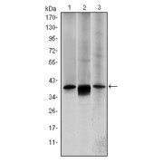 Western blot analysis using MAP2K6 antibody against HepG2 (1), MCF-7 (2) and NIH/3T3 (3) cell lysate.