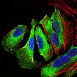 Mitogen-Activated Protein Kinase 14 (MAPK14) Antibody