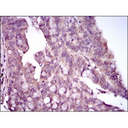 Mitogen-Activated Protein Kinase 14 (MAPK14) Antibody