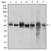 Western blot analysis using MAPK14 antibody against human MAPK14 recombinant protein. (Expected MW is 33 kDa).
