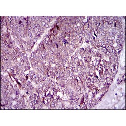 Melanoma Cell Adhesion Molecule (MCAM) Antibody