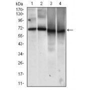 Western blot analysis using MCAM antibody against human MCAM recombinant protein. (Expected MW is 37.7 kDa).