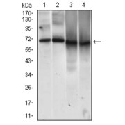 Western blot analysis using MCAM antibody against human MCAM recombinant protein. (Expected MW is 37.7 kDa).