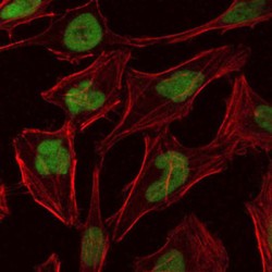 DNA Replication Licensing Factor MCM2 (MCM2) Antibody