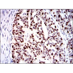 DNA Replication Licensing Factor MCM2 (MCM2) Antibody