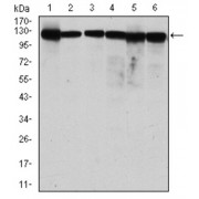 Western blot analysis using MCM2 antibody against human MCM2 (AA: 16-232) recombinant protein. (Expected MW is 50.4 kDa).