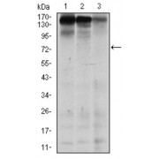 Western blot analysis using MSH6 antibody against human MSH6 (AA: 217-395) recombinant protein. (Expected MW is 45.5 kDa).