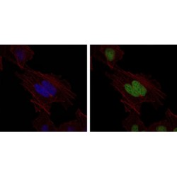 G/T Mismatch-Binding Protein (MSH6) Antibody