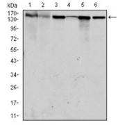 Western blot analysis using MSH6 antibody against human MSH6 (AA: 217-395) recombinant protein. (Expected MW is 45.5 kDa).