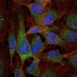 Nuclear Factor NF-Kappa-B P105 Subunit (NFKB1) Antibody