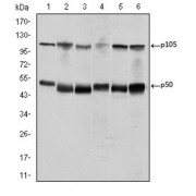 Western blot analysis using NFKB1 antibody against K562 (1), Jurkat (2), A431 (3), Hela (4), THP-1 (5) and MCF-7 (6) cell lysate.