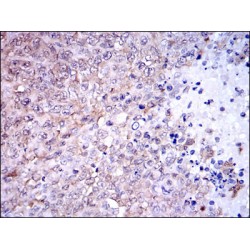 NAD(P)H Dehydrogenase, Quinone 1 (NQO1) Antibody