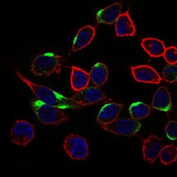 Neuronal Cell Adhesion Molecule (NRCAM) Antibody