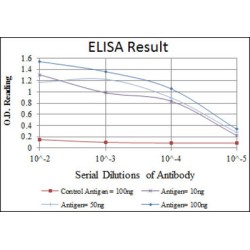 Oligodendrocyte Transcription Factor 2 (OLIG2) Antibody