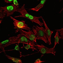 Homeobox Protein OTX2 (OTX2) Antibody