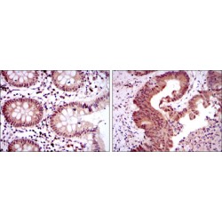 Homeobox Protein OTX2 (OTX2) Antibody