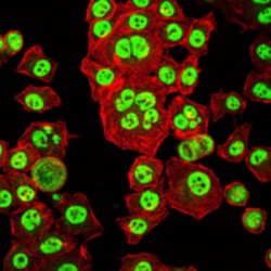 Homeobox Protein OTX2 (OTX2) Antibody