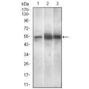 abx015953