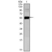 Western blot analysis using PAX6 antibody against human PAX6 (AA: 1-223) recombinant protein. (Expected MW is 50 kDa).