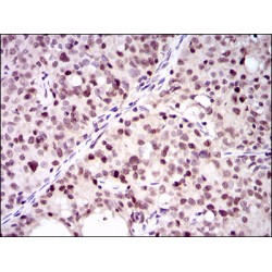 Proliferating Cell Nuclear Antigen (PCNA) Antibody